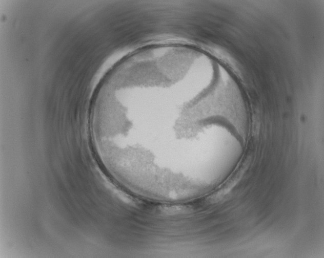 X0000079341231200612082016