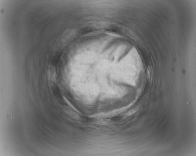 X0000079341251200612082015