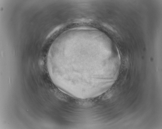 X0000079341254200612082015