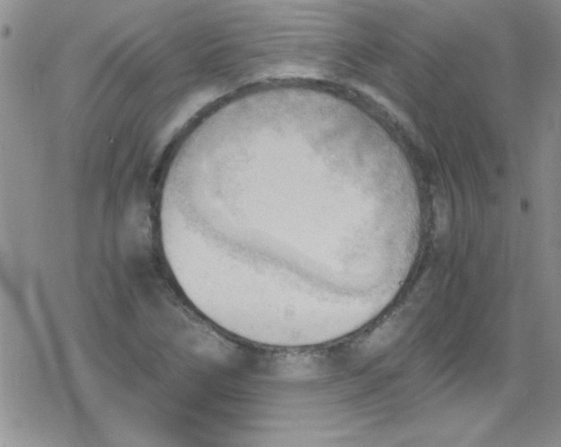 X0000079341266200612082015