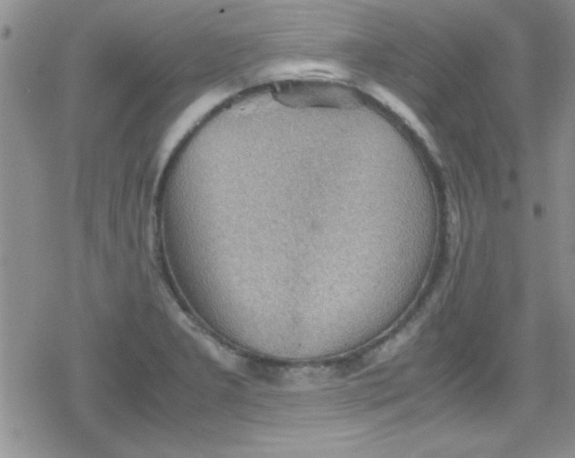 X0000079341277200612082015