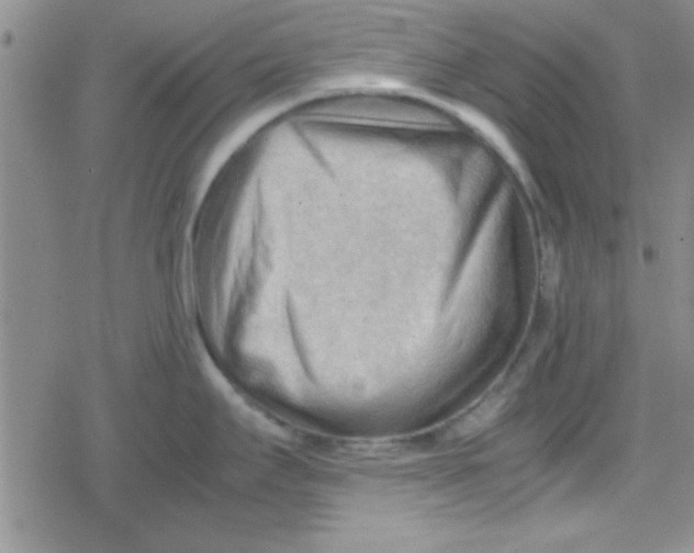 X0000079341295200612082015