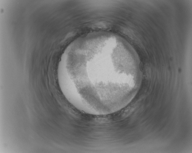 X0000079341297200612082014