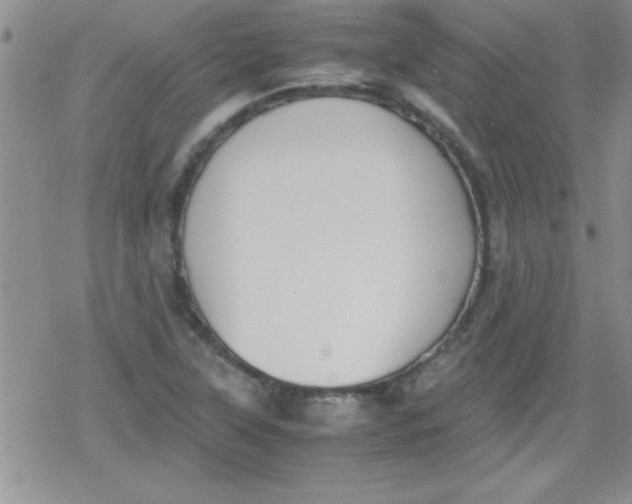 X0000079341315200612082014