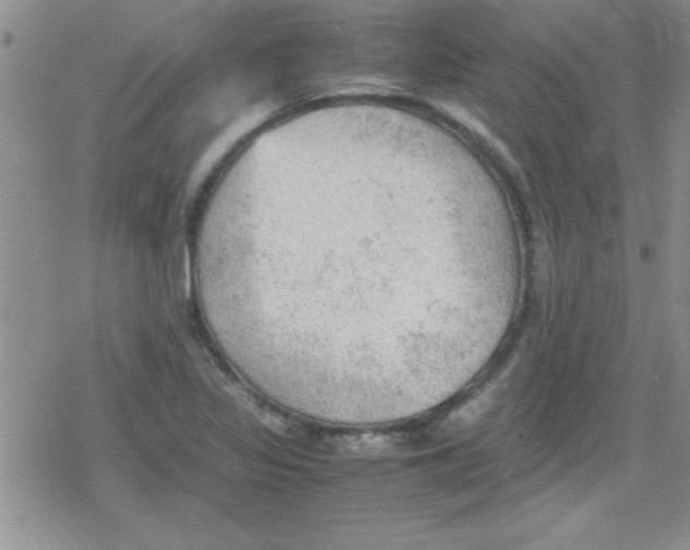 X0000079341317200612082014