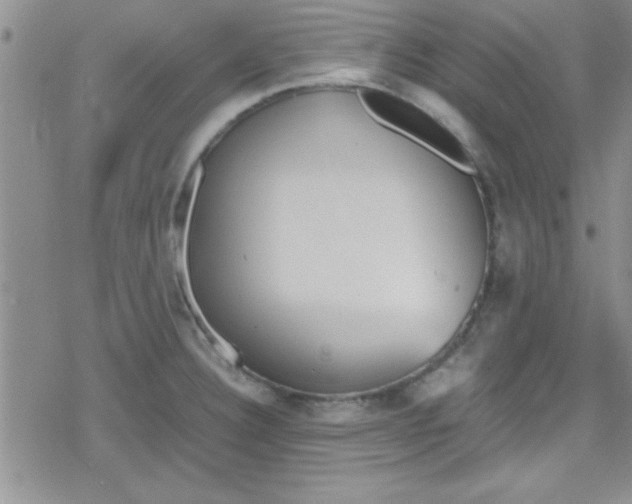 X0000079341332200612082014