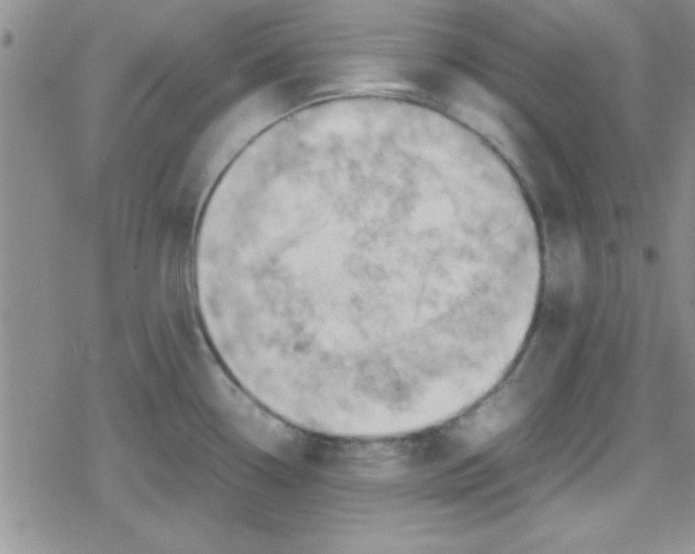 X0000079341338200612082015