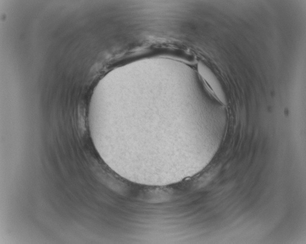 X0000079341348200612082014