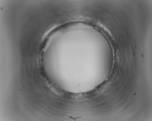 X0000079341352200612082014