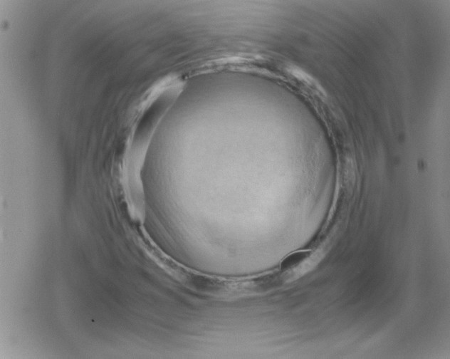 X0000079341353200612082014