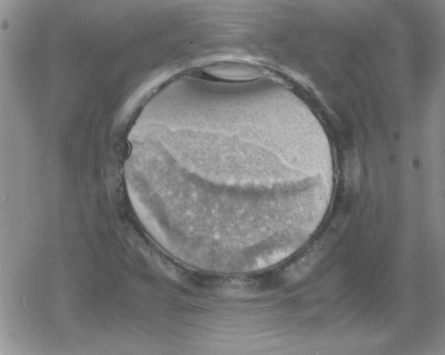 X0000079341359200612082014