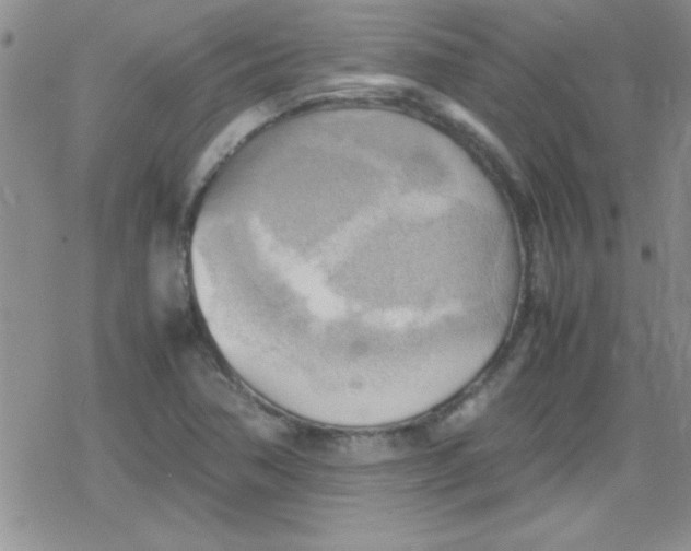 X0000079341362200612082014