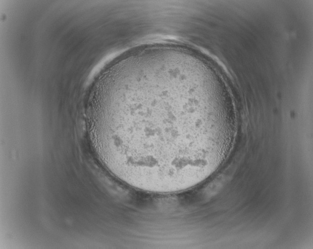 X0000079341363200612082014