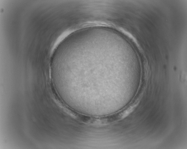 X0000079341365200612082014