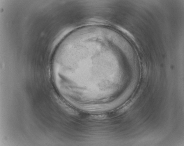 X0000079341415200612082013