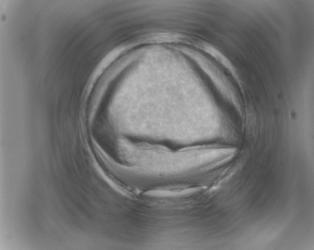 X0000079341429200612082013