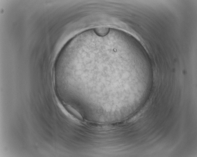 X0000079341515200612082011