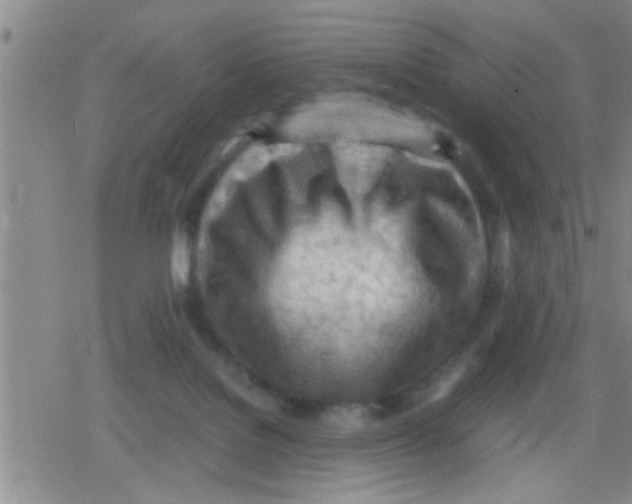 X0000079340076200612151918