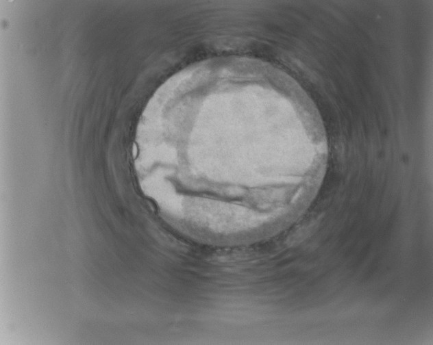 X0000079340817200612151905