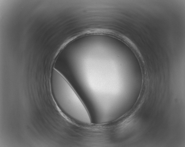 X0000079581041200612010920