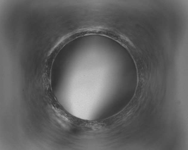 X0000079581256200612011209