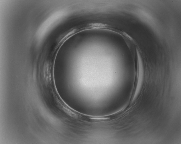 X0000079581487200612011205