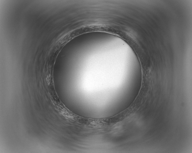 X0000079581015200612081530