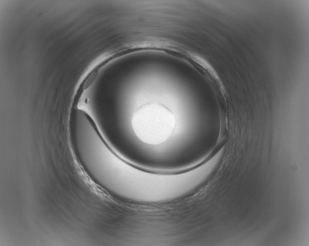 X0000079581138200612081528
