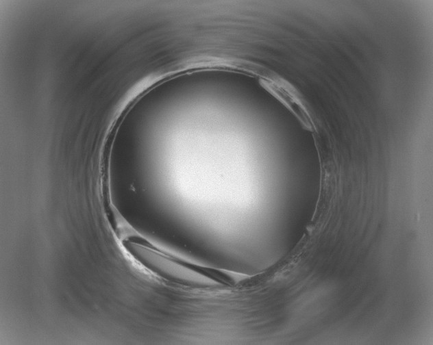 X0000079581143200612081528