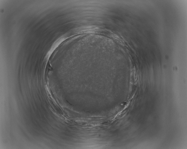 X0000079580099200612221440