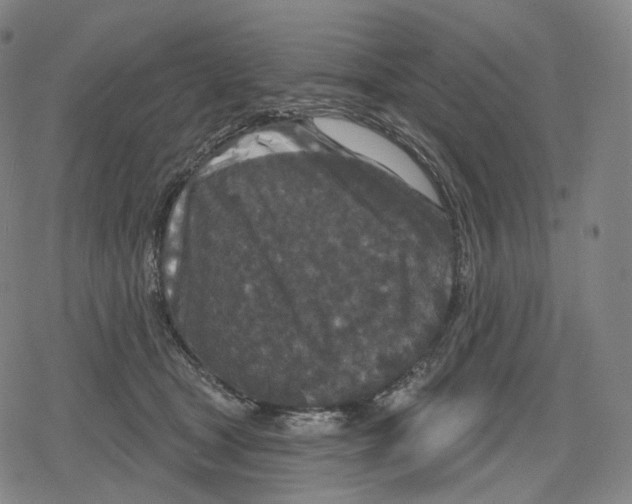 X0000079580465200612221435