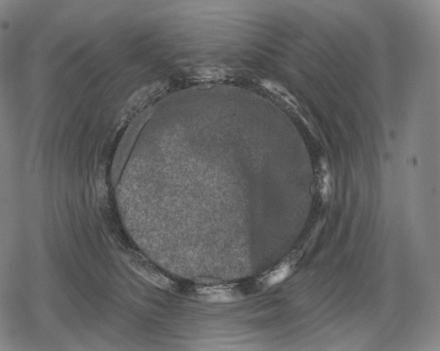 X0000079580516200612221434