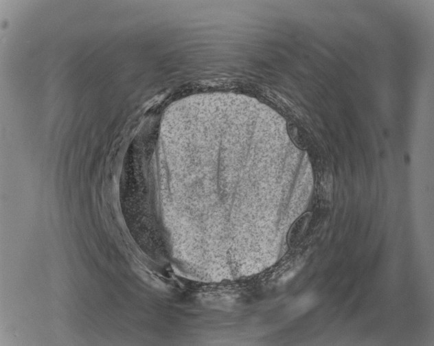 X0000079580817200612221428