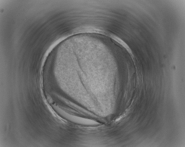 X0000079581144200612221424