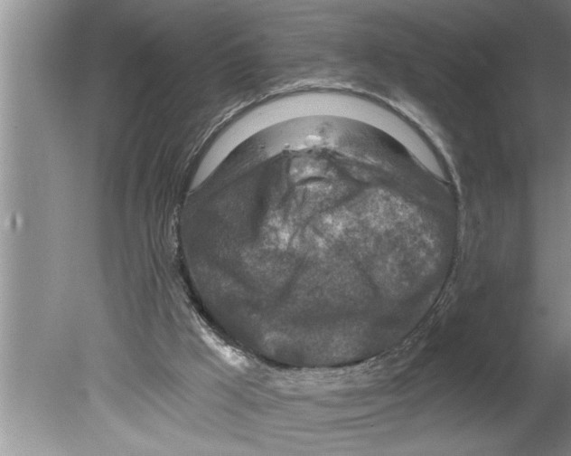 X0000079580009200612301418