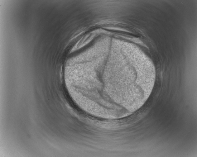 X0000079580024200612301418