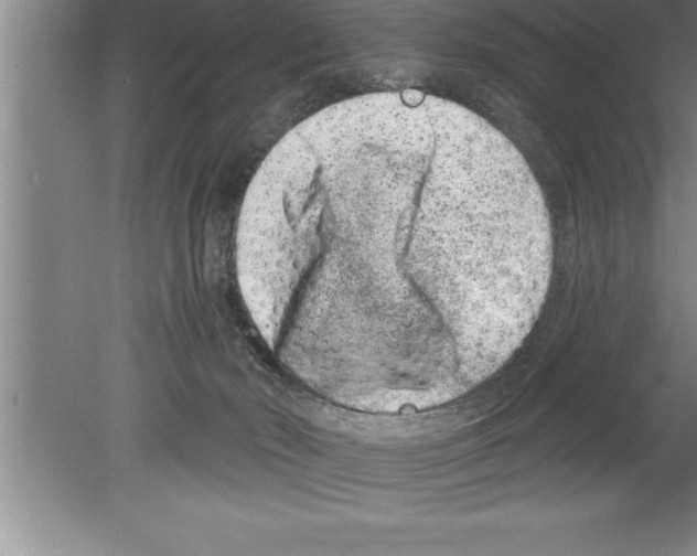 X0000079580030200612301418