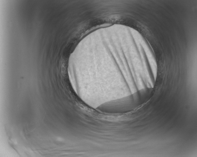 X0000079580037200612301418