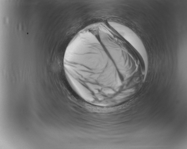 X0000079580039200612301418