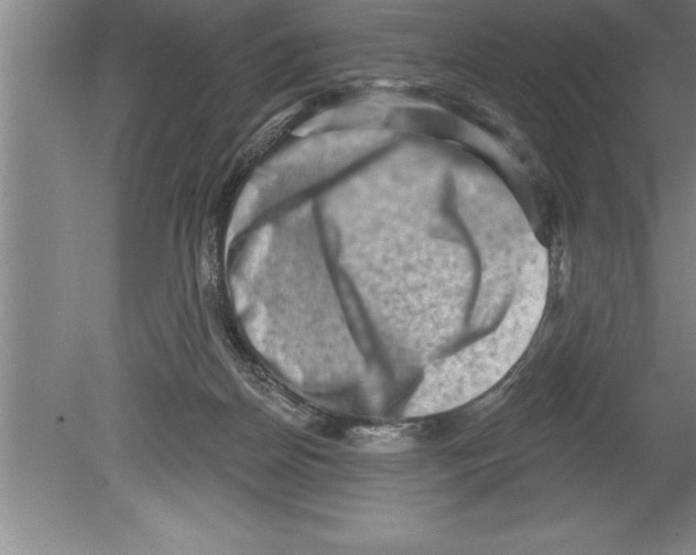 X0000079580170200612301416