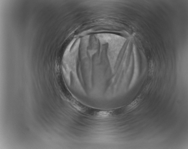 X0000079580176200612301416