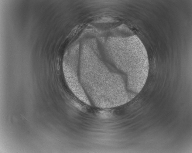 X0000079580232200612301415