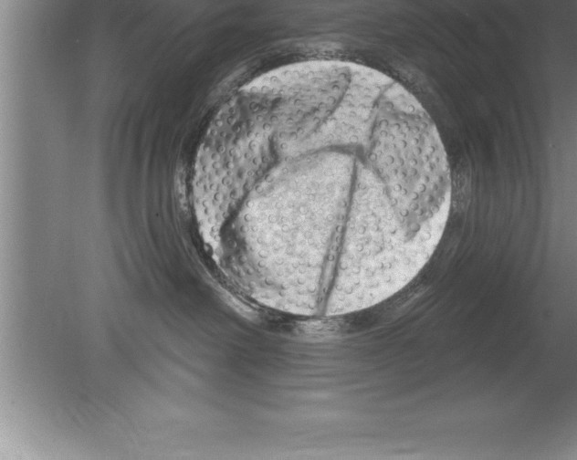 X0000079580238200612301415