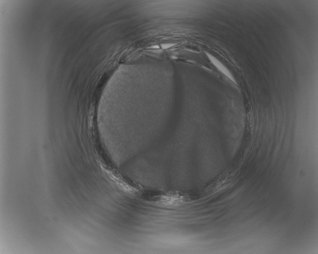 X0000079580458200612301411