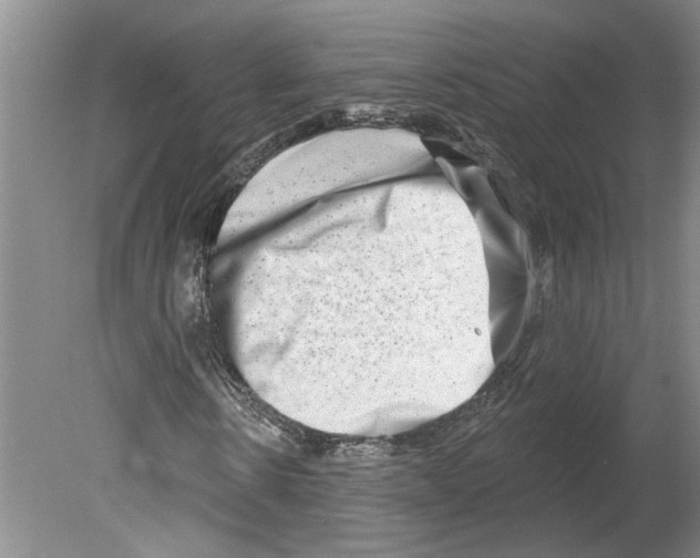 X0000079580914200612301402