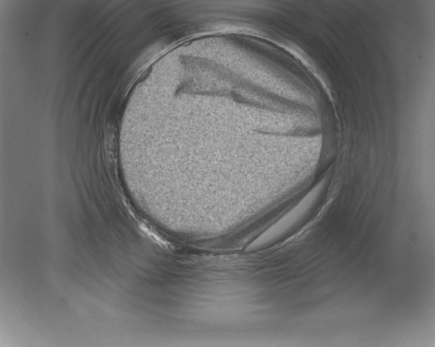 X0000079581001200612301402