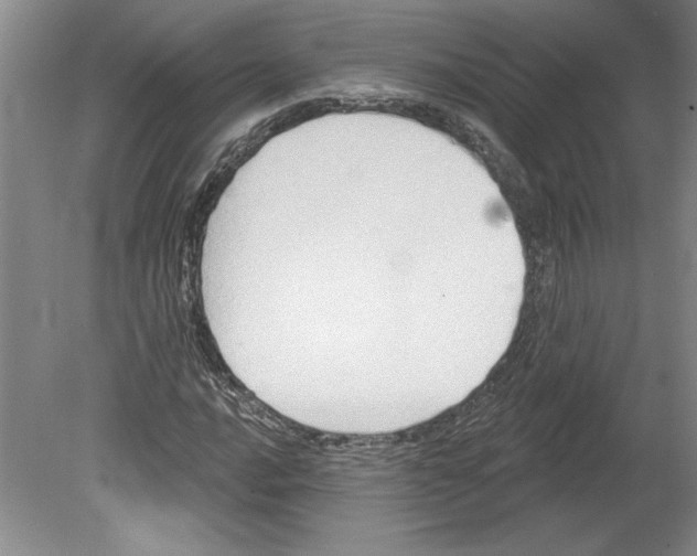 X0000079581016200612301401