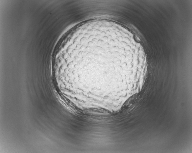 X0000079581036200612301401