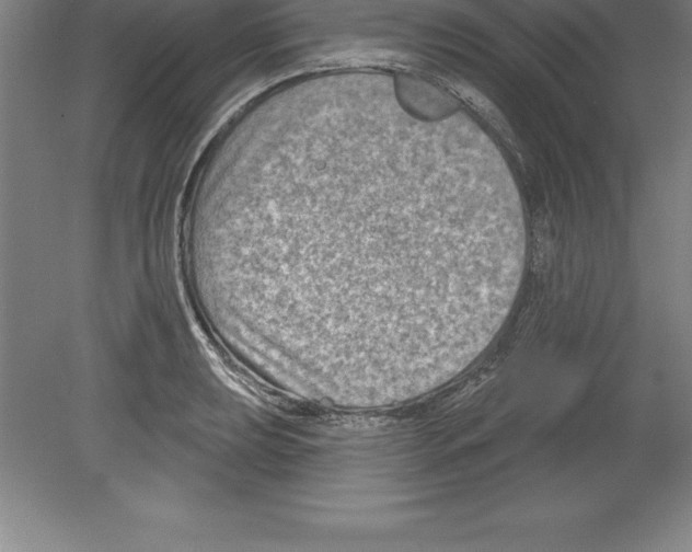 X0000079581039200612301401