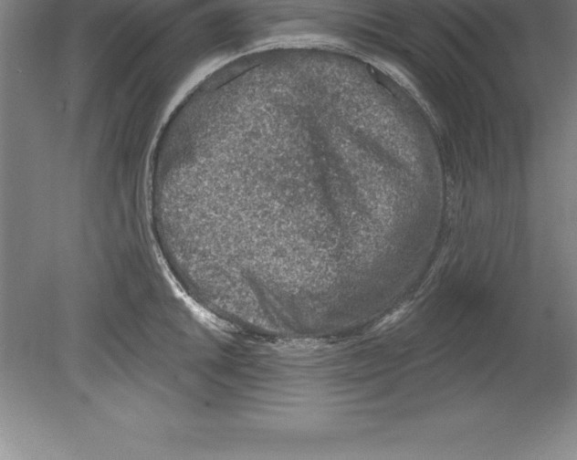 X0000079581046200612301401